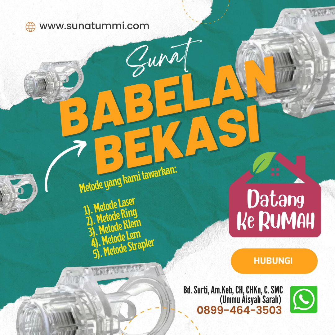 sunat Babelan 2